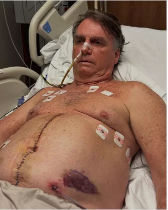 Bolsonaro no hospital hoje